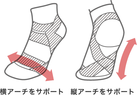 アーチサポート